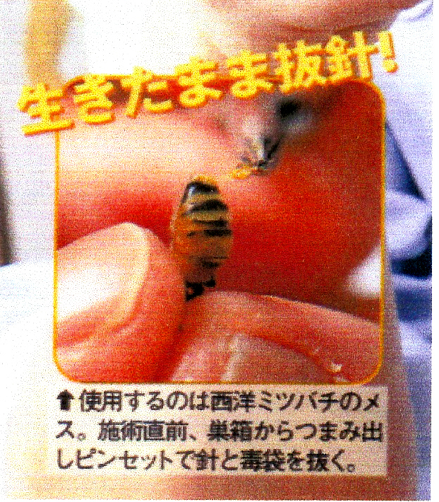 蜂針の健康療法 - 特定非営利活動法人 日本アピセラピー協会へようこそ