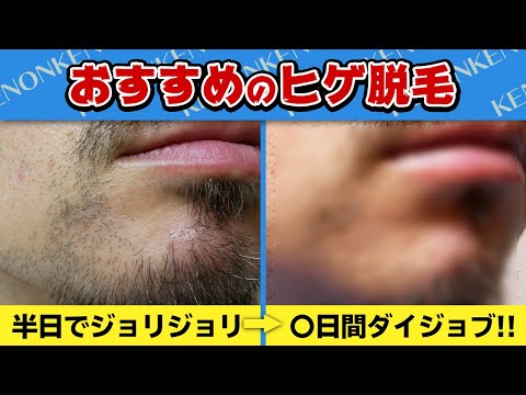 ヒゲ脱毛】ケノンのストロングカートリッジを3カ月やった結果 - YouTube