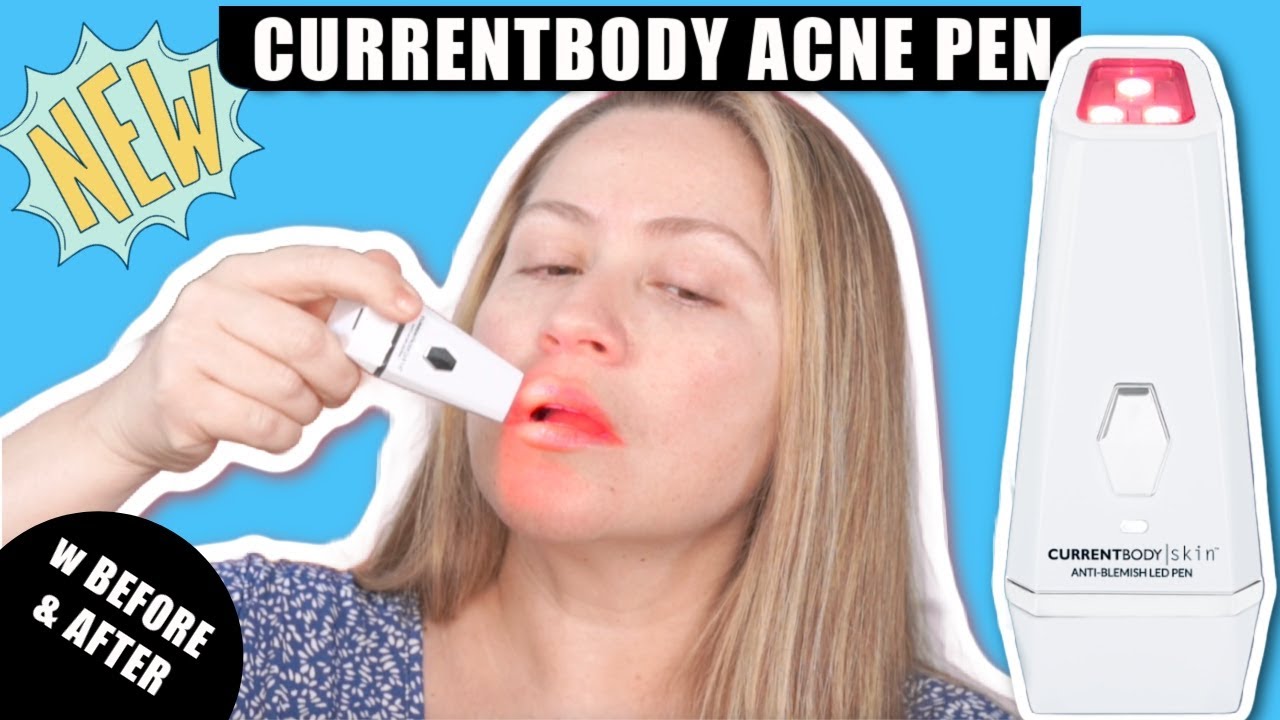 CURRENTBODY SKIN ANTI-ACNE LED PEN | How to get rid of acne
