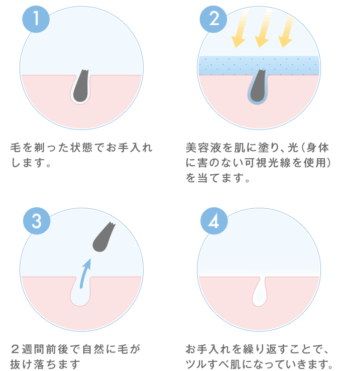 ミュゼプラチナム｜メンズ脱毛・ヒゲ脱毛・全身脱毛【公式】